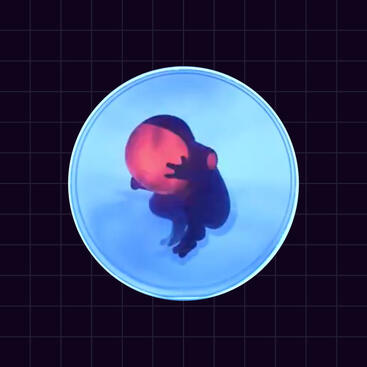 Aura